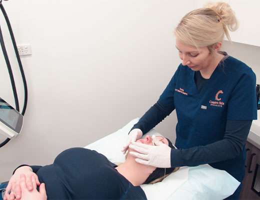 Laser-Treatments-Complete-Skin-Specialist