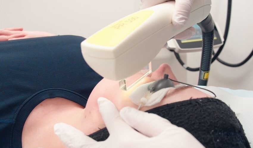 Dermatology laser applied to forehead